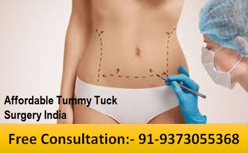Affordable Tummy Tuck Surgery India